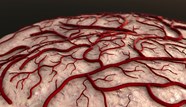 Cerebral Small Vessel Disease May Contribute To Parkinsonism