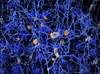 Degree of Amyloid Deposition Helps Predict Cognitive Decline Degree of Amyloid Deposition Helps Predict Cognitive Decline