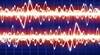 Adjunctive Treatment Improves Control of Partial Seizures Adjunctive Treatment Improves Control of Partial Seizures