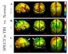 Advanced Neuroimaging Can Guide Interventions in Traumatic Brain Injury Advanced Neuroimaging Can Guide Interventions in Traumatic Brain Injury