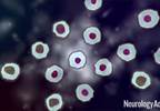 VIDEO: Dysfunctional Mitochondrial DNA May Play a Role in Parkinson's Disease VIDEO: Dysfunctional Mitochondrial DNA May Play a Role in Parkinson's Disease