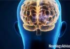 With Costs Rising, A Call for More Neurology Funding With Costs Rising, A Call for More Neurology Funding