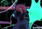 Stroke Prevention Strategies May Help Prevent Dementia Stroke Prevention Strategies May Help Prevent Dementia
