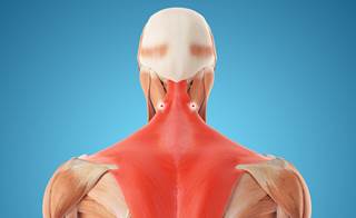 Previous research has shown a more rapid response to intramuscular injections of a long-acting anesthetic into the lower cervical neck. Previous research has shown a more rapid response to intramuscular injections of a long-acting anesthetic into the lower cervical neck.