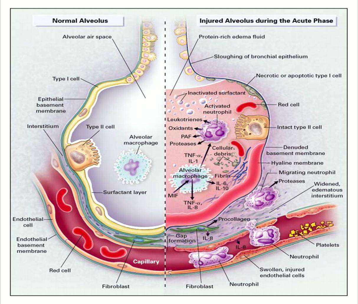 increase in dead space volume in lungs