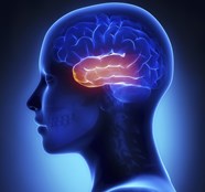 Left Temporal Lobe Resection Linked To Naming Decline In Refractory 