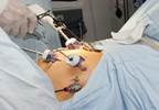 Preoperative Psychiatric Diagnoses Not Associated With Bariatric Surgery Outcomes Preoperative Psychiatric Diagnoses Not Associated With Bariatric Surgery Outcomes