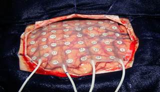 New Guidelines for Treatment of First Seizure New Guidelines for Treatment of First Seizure