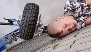 Falls Are a Leading Cause of Head Trauma in Children Falls Are a Leading Cause of Head Trauma in Children