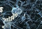 Investigational Alzheimer's Drug Gets FDA Fast Track Investigational Alzheimer's Drug Gets FDA Fast Track