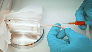 Animal Model Links Hippocampal Insulin Resistance to Neuroplasticity Animal Model Links Hippocampal Insulin Resistance to Neuroplasticity