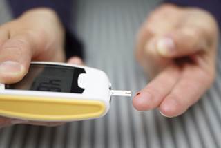 Accelerated Brain Aging Seen in Type 1 Diabetes Accelerated Brain Aging Seen in Type 1 Diabetes