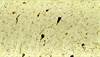 Identifying Biomarkers for Alzheimer's Disease Identifying Biomarkers for Alzheimer's Disease