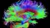 Human Connectome Imaging Advances Could Improve Neurological Care Human Connectome Imaging Advances Could Improve Neurological Care