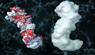 Elevated Amyloid Levels Point to Increased Risk of Cognitive Decline Elevated Amyloid Levels Point to Increased Risk of Cognitive Decline