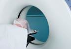 Imaging Use Up, Counseling Down in Headache Imaging Use Up, Counseling Down in Headache