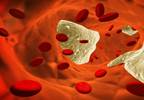 Coffee Consumption Could Help Reduce Risk of Stroke, Heart Attack Coffee Consumption Could Help Reduce Risk of Stroke, Heart Attack