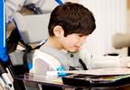 Bevacizumab Associated With Neurodevelopmental Disabilities Bevacizumab Associated With Neurodevelopmental Disabilities