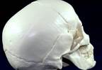 Cognitive Issues Often Mild in Single-Suture Craniosynostosis Cognitive Issues Often Mild in Single-Suture Craniosynostosis