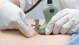 ACOG Updates Recommendations for Prenatal Genetic Screening ACOG Updates Recommendations for Prenatal Genetic Screening