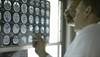 Advances in Neuroimaging for Amyotrophic Lateral Sclerosis Advances in Neuroimaging for Amyotrophic Lateral Sclerosis