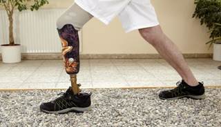 Intuitive Motorized Prosthetic Leg Shows Promise Intuitive Motorized Prosthetic Leg Shows Promise