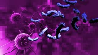 Mitoxantrone Linked to Elevated Cancer Risk in Multiple Sclerosis Patients Mitoxantrone Linked to Elevated Cancer Risk in Multiple Sclerosis Patients