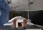 Lack of Clear Mortality Measures May Be Sabotaging Epilepsy Research, Care Lack of Clear Mortality Measures May Be Sabotaging Epilepsy Research, Care
