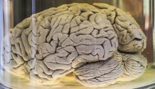Traumatic Brain Injury Linked to Parkinson's, Lewy Body Pathology Traumatic Brain Injury Linked to Parkinson's, Lewy Body Pathology