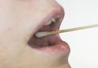 Saliva May Help Distinguish Between Forms of Cognitive Impairment Saliva May Help Distinguish Between Forms of Cognitive Impairment
