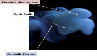 Image of the lab-grown brain organioid with identifying structures. Image of the lab-grown brain organioid with identifying structures.