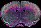 Neuropsychiatric Symptoms Occur More Frequently in Relatives of Patients With ALS Neuropsychiatric Symptoms Occur More Frequently in Relatives of Patients With ALS