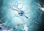 Expression of DICAM on TH17 Lymphocytes Documented in Neuroinflammation Expression of DICAM on TH17 Lymphocytes Documented in Neuroinflammation