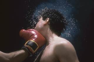 Concussion, Isolated Mandible Fractures Often Co-Occurring Concussion, Isolated Mandible Fractures Often Co-Occurring