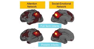 Image courtesy Washington University School of Medicine Image courtesy Washington University School of Medicine