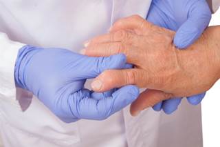Long-Term NSAID Use in Rheumatoid Arthritis Decreases Dementia Risk Long-Term NSAID Use in Rheumatoid Arthritis Decreases Dementia Risk