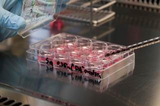Double Autologous Stem Cell Transplants Boost Survival in Neuroblastoma Double Autologous Stem Cell Transplants Boost Survival in Neuroblastoma
