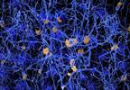 Periventricular White Matter Hyperintensities May Signify Alzheimer's Risk Periventricular White Matter Hyperintensities May Signify Alzheimer's Risk