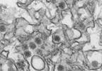 Zika Virus-Associated Neurogenic Bladder Requires Prompt Management Zika Virus-Associated Neurogenic Bladder Requires Prompt Management