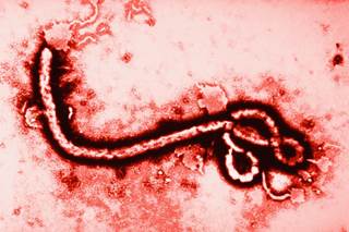 Neurological Symptoms Persist Long After Ebola Infection Neurological Symptoms Persist Long After Ebola Infection