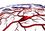 Obesity, Oral Contraceptives Increase Risk of Cerebral Venous Thrombosis Obesity, Oral Contraceptives Increase Risk of Cerebral Venous Thrombosis