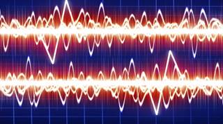 Can Deep Brain Stimulation Improve Deficits From Traumatic Brain Injury? Can Deep Brain Stimulation Improve Deficits From Traumatic Brain Injury?
