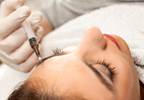 OnabotulinumtoxinA May Be Effective for Chronic Migraine With Medication Overuse OnabotulinumtoxinA May Be Effective for Chronic Migraine With Medication Overuse
