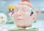 SSRI vs tDCS for Depression: Which is Better? SSRI vs tDCS for Depression: Which is Better?