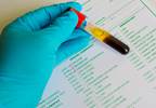Hypocalcemia May Worsen Bleeding in Intracerebral Hemorrhage Hypocalcemia May Worsen Bleeding in Intracerebral Hemorrhage