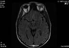 Modifiable CV Risk Factors Within Healthy Range Indicative of CV Morphology, White Matter Lesions Modifiable CV Risk Factors Within Healthy Range Indicative of CV Morphology, White Matter Lesions