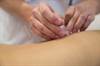 Acupuncture Relieves Pain Associated With Trigeminal Neuralgia Acupuncture Relieves Pain Associated With Trigeminal Neuralgia