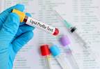 Ischemic Stroke, Myocardial Infarction Both Tied to Lipoproteins, Lipids Ischemic Stroke, Myocardial Infarction Both Tied to Lipoproteins, Lipids