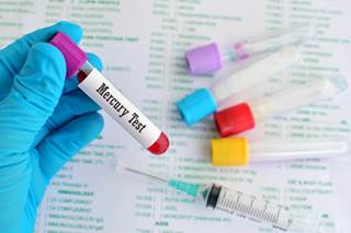Mercury Exposure Attentuates Cognitive Benefits of Exercise Mercury Exposure Attentuates Cognitive Benefits of Exercise