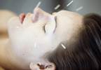 Alternative Treatments for Migraine: A Research Update Alternative Treatments for Migraine: A Research Update